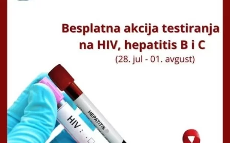 Akcija testiranja na HIV i hepatitisu ZZJZ Šabac
